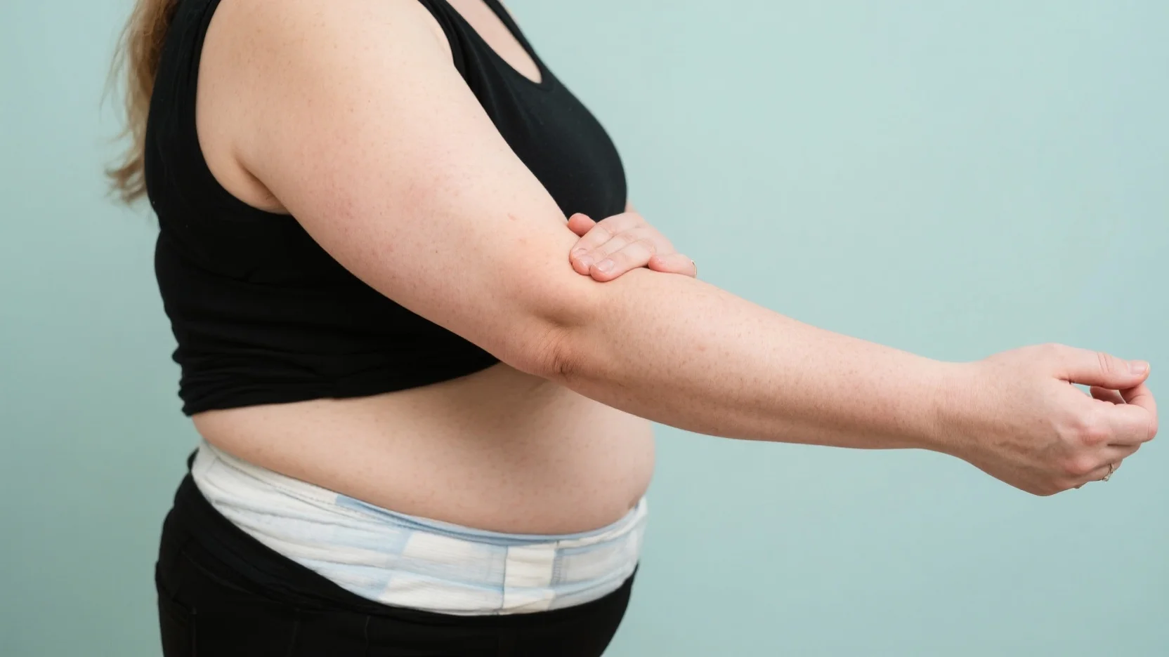 Post-Massive Weight Loss Surgery: Arm Lift (Brachioplasty) vs Circumferential Body Lifting – A Comprehensive Comparison